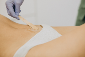 Suikerepilatie bikinilijn