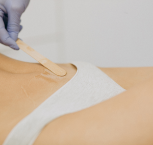 Suikerepilatie bikinilijn